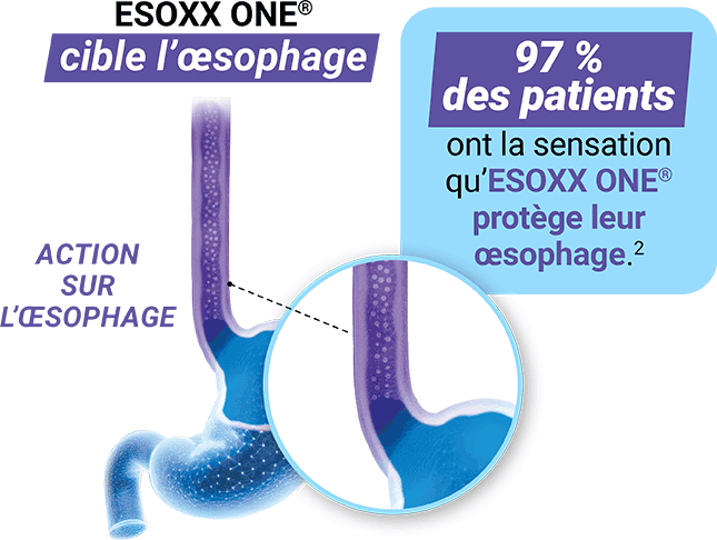 ESOXX ONE® cible l’œsophage, 97 % des patients ont la sensation qu’ESOXX ONE® protège leur œsophage.(2)